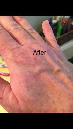 no more eczema organic handmade soap